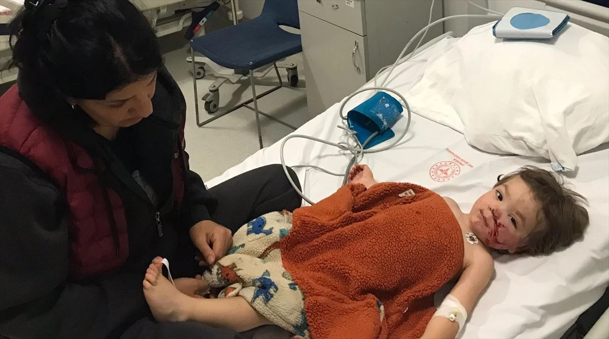 Başkent’te yasaklı Pitbull dehşeti: İki bebeğe korkunç saldırı