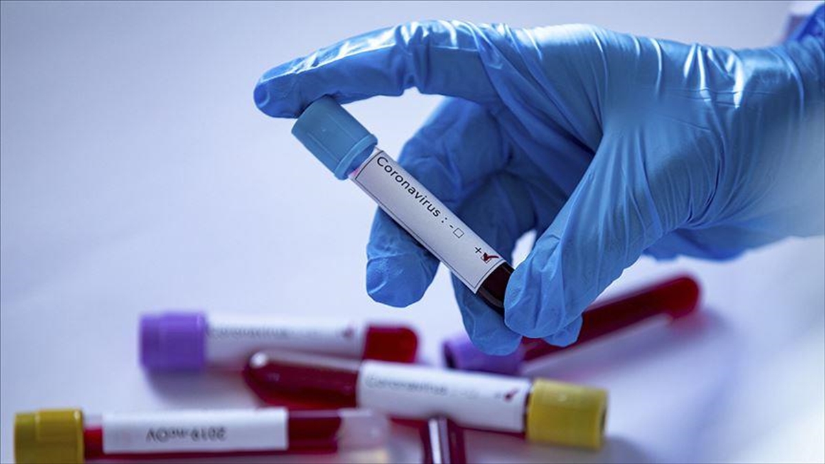 Araştırma: Tekrarlanan Kovid-19 enfeksiyonları “organ yetmezliği ve ölümlere” yol açabilir