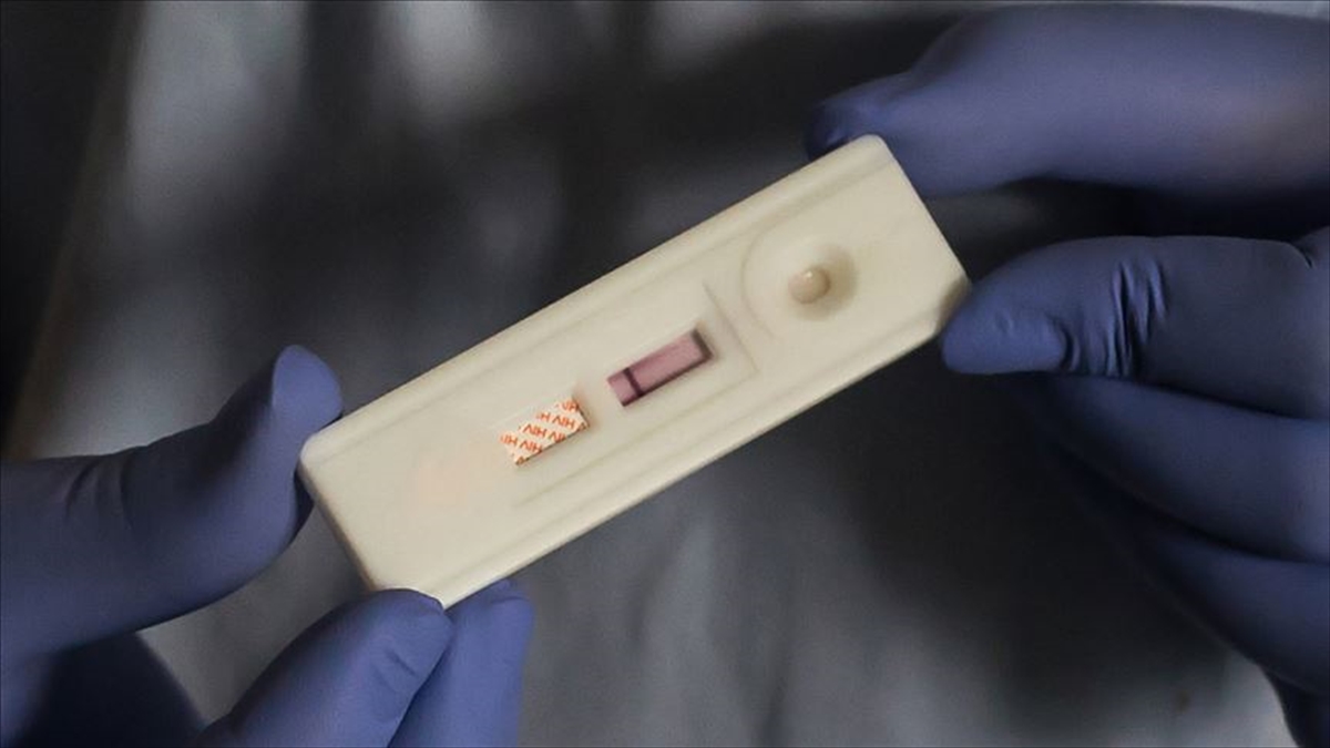 Resmi kayıtlara göre Türkiye’de 32 bin 376 kişi HIV ile yaşıyor