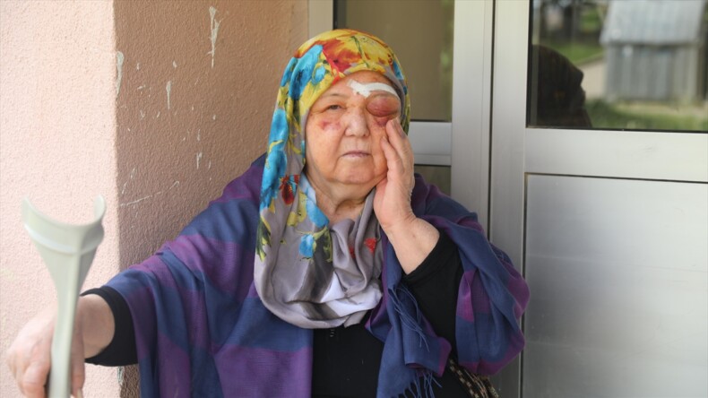 Edirne’de sahipsiz köpeklerden kaçarken düşen yaşlı kadın yaralandı